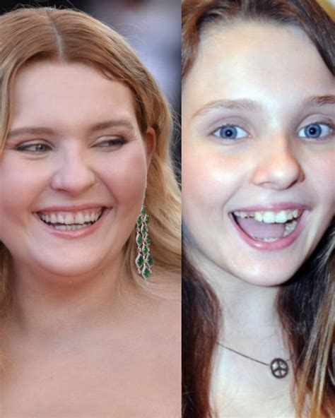 abigail breslin teeth|Abigail Breslin Teeth: The Evolution of Her Smile